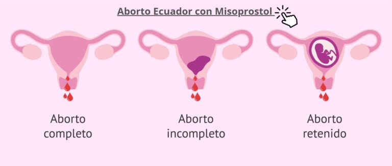 Aborto seguro en Cuenca con Cytotec